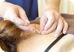 鍼灸・手技療法